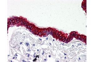 Anti-SCO2 antibody IHC of human lung, respiratory epithelium. (SCO2 Antikörper  (C-Term))