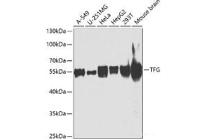 Western blot analysis of extracts of various cell lines using TFG Polyclonal Antibody at dilution of 1:1000. (TFG Antikörper)