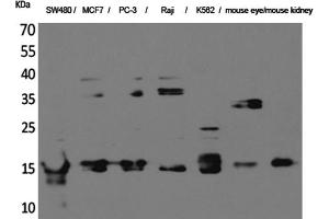 Western Blotting (WB) image for anti-MK (Internal Region) antibody (ABIN5956379) (MK (Internal Region) Antikörper)