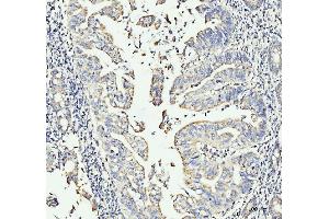 IHC analysis of MOV10 using anti-MOV10 antibody (ABIN7600236). (MOV10 Antikörper  (AA 167-772))