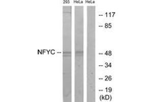 Western blot analysis of extracts from HeLa/293 cells, using NFYC Antibody.