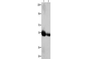 Gel: 10 % SDS-PAGE, Lysate: 60 μg, Lane 1-2: Human liver cancer tissue, Human bladder carcinoma tissue, Primary antibody: ABIN7128892(CEACAM1 Antibody) at dilution 1/400, Secondary antibody: Goat anti rabbit IgG at 1/8000 dilution, Exposure time: 2 minutes (CEACAM1 Antikörper)