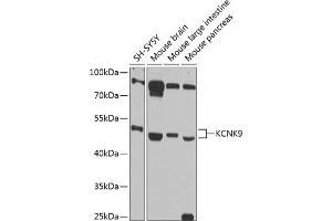 Western blot analysis of extracts of various cell lines, using KCNK9 antibody (ABIN6128568, ABIN6142756, ABIN6142758 and ABIN6216267) at 1:1000 dilution. (KCNK9 Antikörper  (AA 265-374))