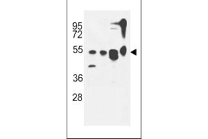 ATG13 Antibody (N-term) (ABIN653882 and ABIN2843129) western blot analysis in MDA-M,CEM,T47D cell line and mouse cerebellum tissue lysates (35 μg/lane).