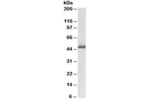 Western blot testing of human prostate lysate with ACPP antibody at 0. (ACPP Antikörper)