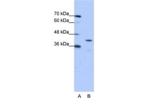 Western Blotting (WB) image for anti-Cytoplasmic Polyadenylation Element Binding Protein 2 (CPEB2) antibody (ABIN2462354) (CPEB2 Antikörper)