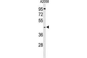 Western blot analysis of GPSN2 (arrow) in A2058 cell line lysates (35ug/lane) using TECR / GPSN2  (TECR Antikörper  (C-Term))