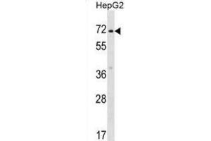 Western Blotting (WB) image for anti-Zinc Finger Protein 155 (ZNF155) antibody (ABIN2999111) (ZNF155 Antikörper)
