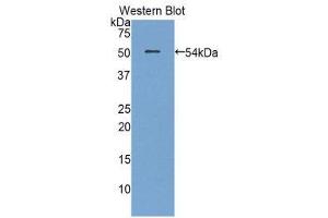 Western Blotting (WB) image for anti-Plasminogen Activator, Urokinase Receptor (PLAUR) (AA 15-211) antibody (FITC) (ABIN1860909) (PLAUR Antikörper  (AA 15-211) (FITC))