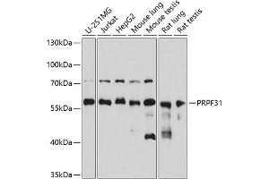 Western blot analysis of extracts of various cell lines, using PRPF31 antibody (ABIN6132996, ABIN6146262, ABIN6146264 and ABIN6221399) at 1:3000 dilution.