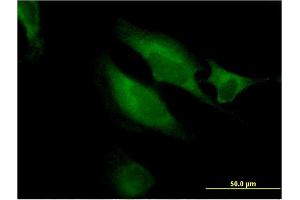 Immunofluorescence of monoclonal antibody to RAB9B on HeLa cell. (RAB9B Antikörper  (AA 102-201))
