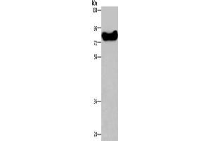Gel: 8 % SDS-PAGE, Lysate: 40 μg, Lane: HepG2 cells, Primary antibody: ABIN7129183(DDX43 Antibody) at dilution 1/200, Secondary antibody: Goat anti rabbit IgG at 1/8000 dilution, Exposure time: 1 minute (DDX43 Antikörper)