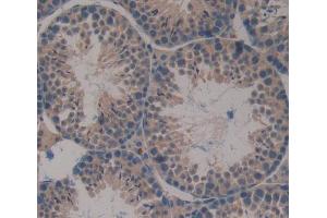 Used in DAB staining on fromalin fixed paraffin- embedded Kidney tissue (NUP37 Antikörper  (AA 87-324))