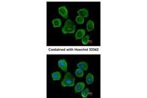ICC/IF Image Immunofluorescence analysis of methanol-fixed A431, using PTGFRN, antibody at 1:500 dilution. (PTGFRN Antikörper  (C-Term))