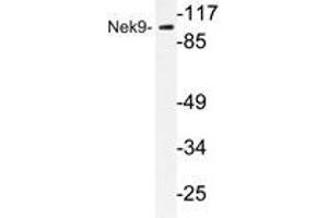 Western blot analysis of Nek9 antibody in extracts from A549 cells. (NEK9 Antikörper)