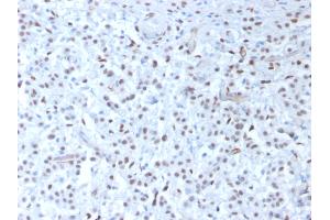 ABIN6383829 to WT1 was successfully used to stain nuclei in sections of human mesothelioma and in human and rat testis sections. (Rekombinanter WT1 Antikörper)