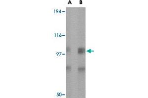 Western blot analysis of GRIK1 in rat brain tissue lysate with GRIK1 polyclonal antibody  at (A) 0.