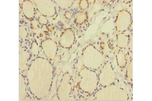 Immunohistochemistry of paraffin-embedded human thyroid tissue using ABIN7172031 at dilution of 1:100 (TXNL1 Antikörper  (AA 2-289))