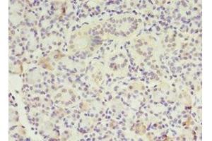 Immunohistochemistry of paraffin-embedded human pancreatic tissue using ABIN7159589 at dilution of 1:100 (MTRR Antikörper  (AA 1-725))