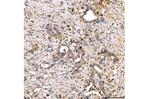 IHC analysis of Alpha 2 Antiplasmin/SERPINF2 using anti-Alpha 2 Antiplasmin/SERPINF2 antibody (ABIN7601808).
