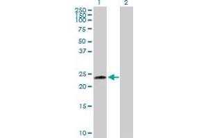 Western Blot analysis of UBE2T expression in transfected 293T cell line by UBE2T MaxPab polyclonal antibody. (Ube2t Antikörper  (AA 1-197))