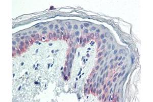 Immunohistochemical analysis of paraffin-embedded human skin tissues using CK5 mouse mAb. (Cytokeratin 5 Antikörper)