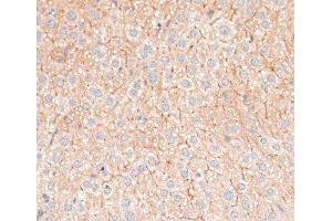 Immunohistochemistry (Paraffin-embedded Sections) (IHC (p)) image for anti-Cadherin 18, Type 2 (CDH18) antibody (ABIN7258012)