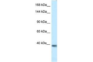 WB Suggested Anti-Kcnq2 Antibody   Titration: 1. (KCNQ2 Antikörper  (Middle Region))