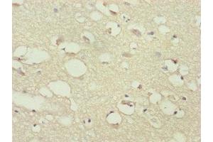 Immunohistochemistry (IHC) image for anti-Protein Phosphatase 2, Regulatory Subunit B'', gamma (PPP2R3C) (AA 1-160), (Regulatory Subunit B) antibody (ABIN7169284)