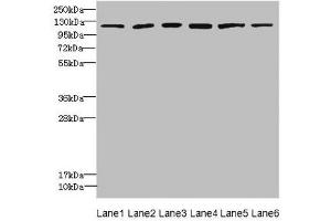 Western blot All lanes: UBE4A antibody at 2. (UBE4A Antikörper  (AA 797-1066))