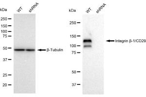 Western blotting analysis using Integrin beta-1/CD29 antibody (ABIN7799067). (Rekombinanter ITGB1 Antikörper)