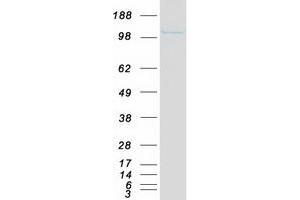 Validation with Western Blot