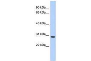 Image no. 1 for anti-SERTA Domain Containing 2 (SERTAD2) (AA 35-84) antibody (ABIN6741105) (SERTAD2 Antikörper  (AA 35-84))