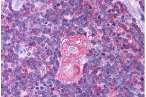 Human Thymus (formalin-fixed, paraffin-embedded) stained with NFKB1 antibody ABIN218608 at 1:500 followed by biotinylated goat anti-rabbit IgG secondary antibody ABIN481713, alkaline phosphatase-streptavidin and chromogen.