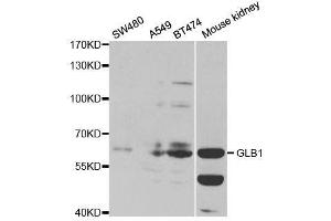 Western Blotting (WB) image for anti-Galactosidase, beta 1 (GLB1) (AA 1-270) antibody (ABIN3015643)