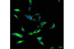 Immunofluorescent analysis of Hela cells using ABIN7150692 at dilution of 1:100 and Alexa Fluor 488-congugated AffiniPure Goat Anti-Rabbit IgG(H+L)