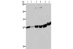Western Blotting (WB) image for anti-Melanin-Concentrating Hormone Receptor 1 (MCHR1) antibody (ABIN2434978) (MCHR1 Antikörper)