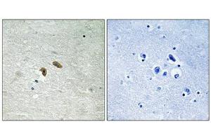 Immunohistochemical analysis of paraffin-embedded human brain tissue using C-RAF (Phospho-Thr269) antibody (left)or the same antibody preincubated with blocking peptide (right). (RAF1 Antikörper  (pThr269))
