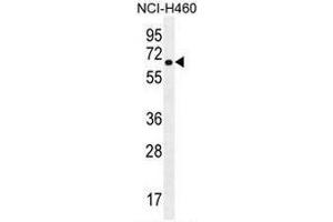 Western Blotting (WB) image for anti-Cholinergic Receptor, Nicotinic, delta (Muscle) (CHRND) (AA 175-204), (Middle Region), (Subunit delta) antibody (ABIN950235)