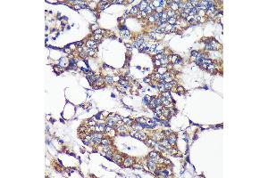 Immunohistochemistry of paraffin-embedded Human colon carcinoma using SLIRP Rabbit pAb (ABIN7270560) at dilution of 1:100 (40x lens). (SLIRP Antikörper  (AA 1-100))