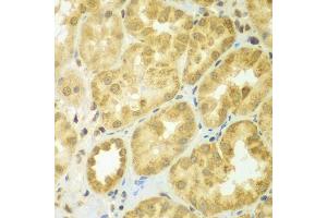 Immunohistochemistry of paraffin-embedded human kidney using ADCK3 antibody (ABIN5975514) at dilution of 1/100 (40x lens). (COQ8A Antikörper)