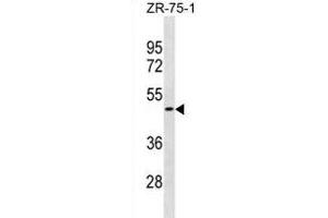 OR1S2 Antibody (C-term) (ABIN1881599 and ABIN2838716) western blot analysis in ZR-75-1 cell line lysates (35 μg/lane). (OR1S2 Antikörper  (C-Term))