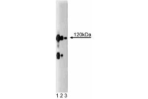 Western blot analysis of CASK on a rat cerebrum lysate. (CASK Antikörper  (AA 353-486))
