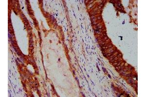 Immunohistochemistry (IHC) image for anti-Cadherin 1, Type 1, E-Cadherin (Epithelial) (CDH1) (AA 23-621) antibody (ABIN7146195)