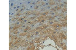 IHC-P analysis of esophagus tissue, with DAB staining. (FPGT Antikörper  (AA 127-377))