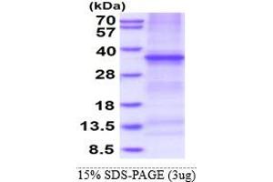 SDS-PAGE (SDS) image for Tumor Necrosis Factor Receptor Superfamily, Member 6b, Decoy (TNFRSF6B) (AA 30-300) protein (His tag) (ABIN5853355)