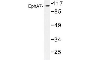 Image no. 1 for anti-EPH Receptor A7 (EPHA7) antibody (ABIN272234) (EPH Receptor A7 Antikörper)