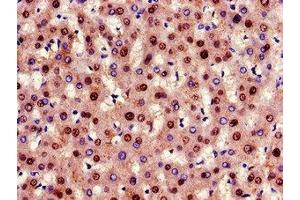 Immunohistochemistry of paraffin-embedded human liver tissue using ABIN7153869 at dilution of 1:100 (Glucagon Receptor Antikörper  (AA 26-136))