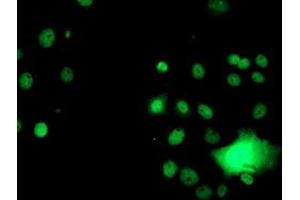 Anti-GSTT2 mouse monoclonal antibody (ABIN2453879) immunofluorescent staining of COS7 cells transiently transfected by pCMV6-ENTRY GSTT2 (RC200040). (GSTT2 Antikörper)
