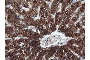 Immunohistochemical staining of paraffin-embedded Human liver tissue using anti-CYP2A6 mouse monoclonal antibody. (CYP2A6 Antikörper)